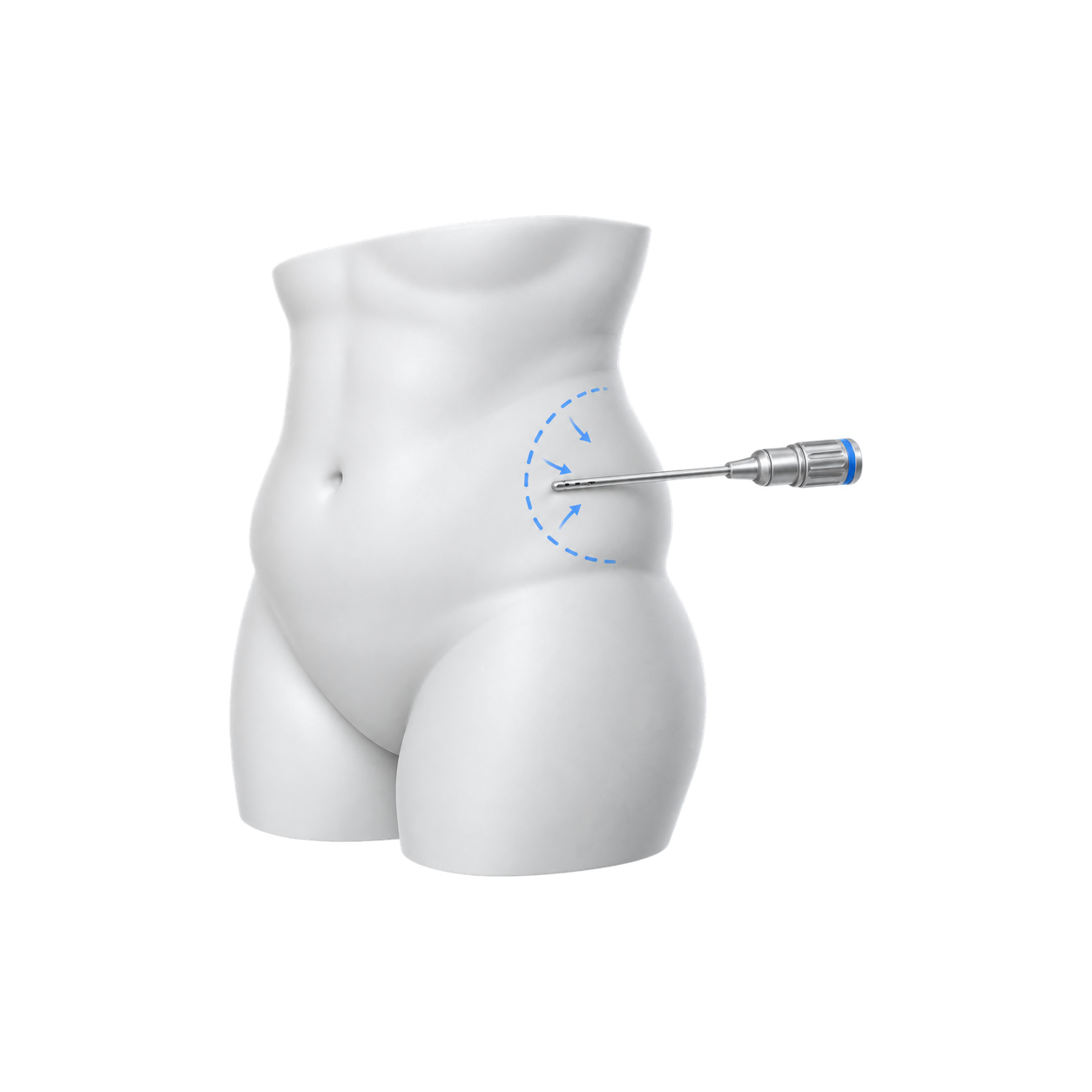 3D-иконка липосакции